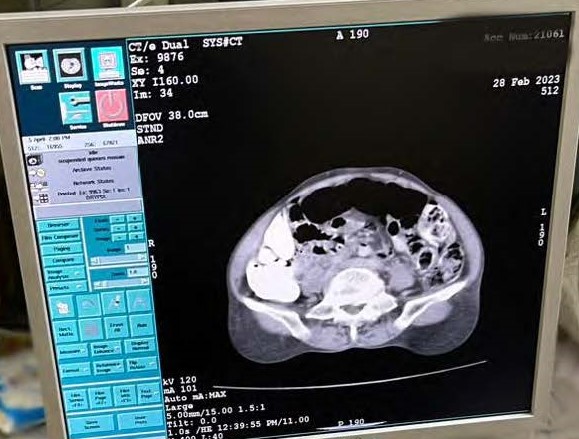 Used GE HISPEED DUAL CT Scan for sale (ID 13039017732) | 20Med