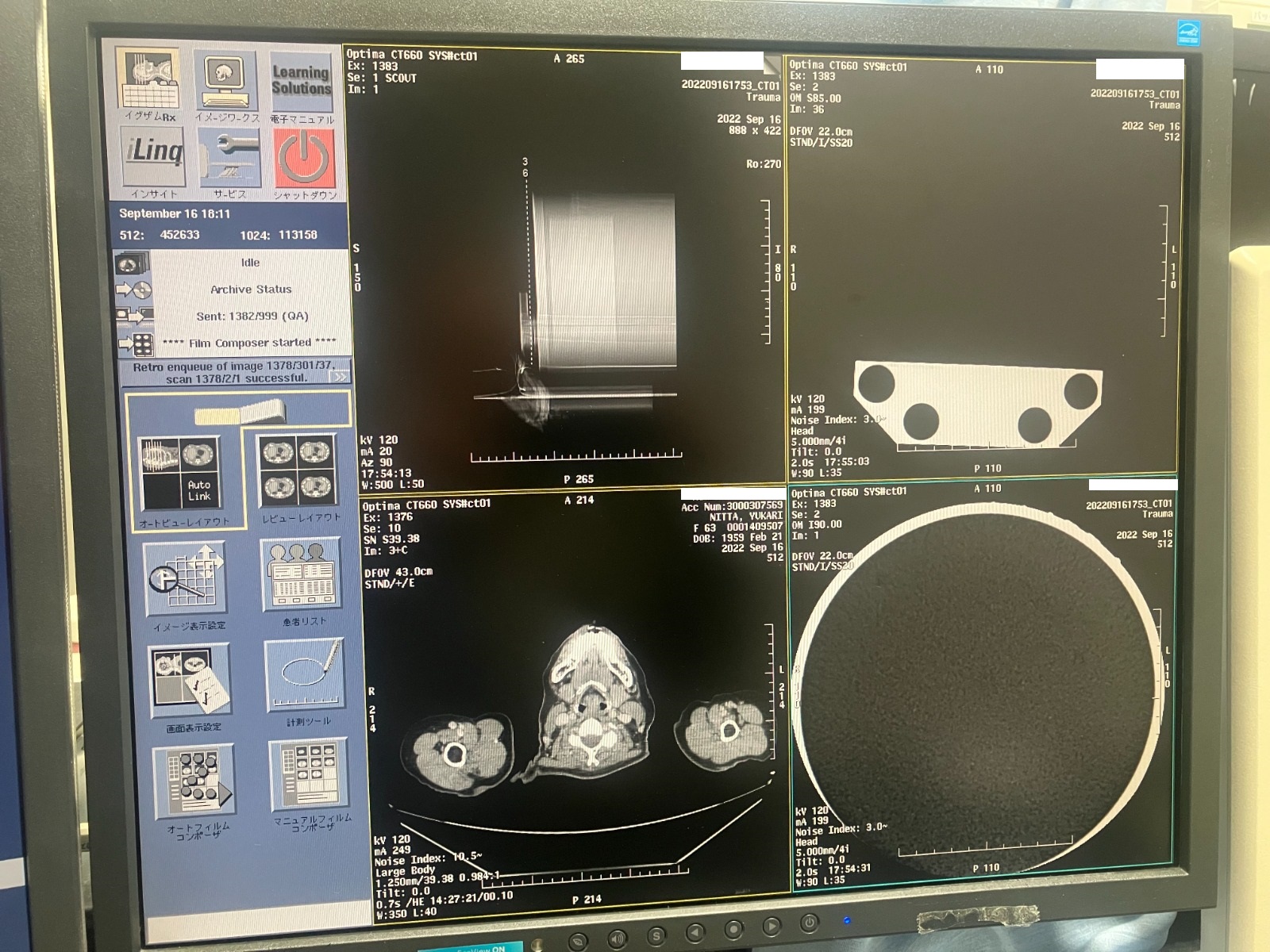 Used GE Optima CT660 CT Scan for sale (ID 2019) | 20Med
