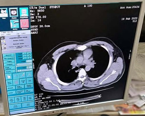 20Med CT Scan GE HEALTHCARE HISPEED DUAL