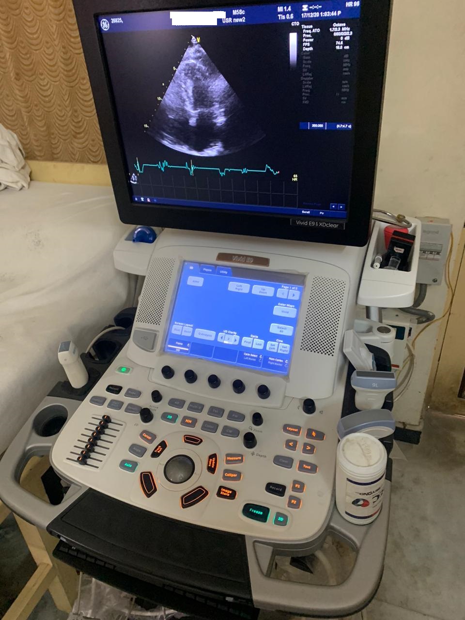 Used GE Healthcare VIVID E9 Ultrasound