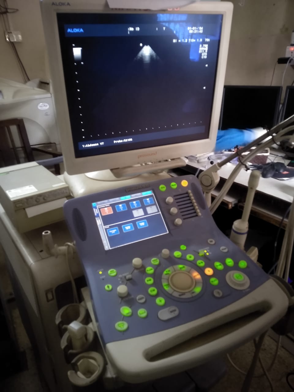 Refurbished Hitachi Aloka Medical ProSound Alpha 10 Ultrasound