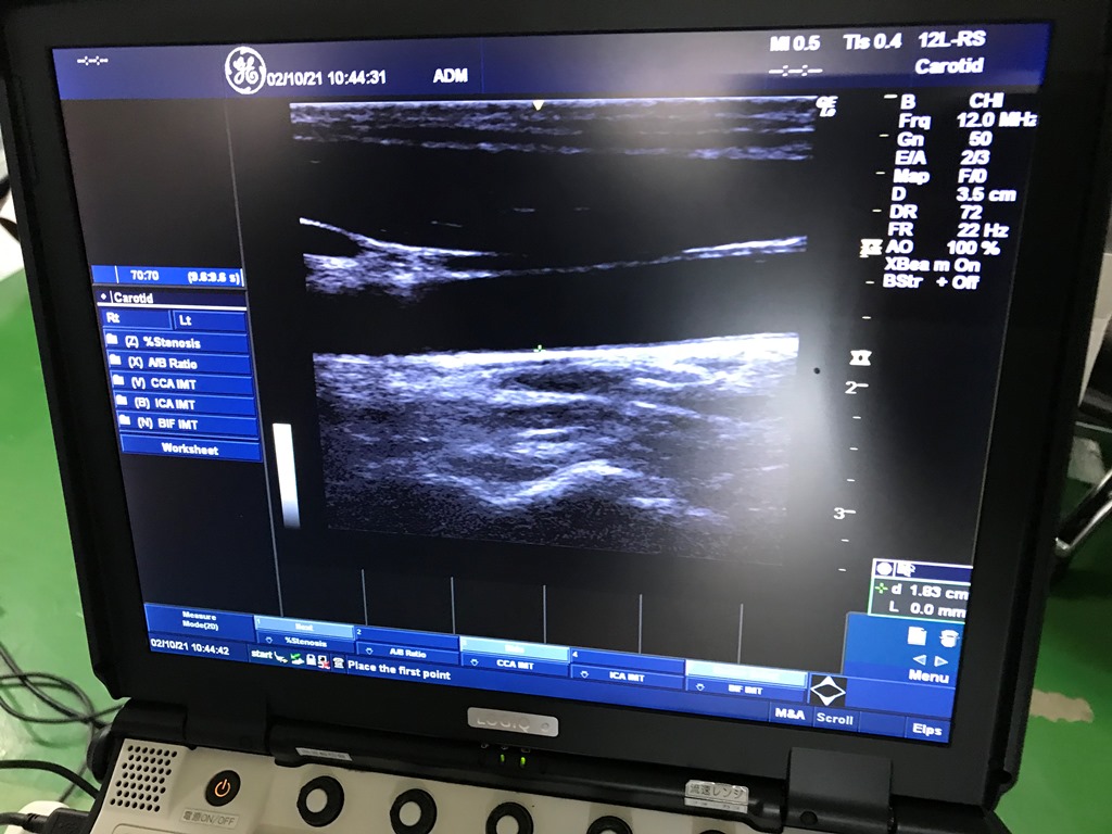 Refurbished GE Healthcare LOGIQｅ Ultrasound