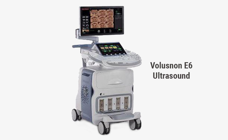 Used GE Healthcare Voluson E6 Ultrasound