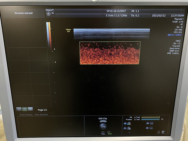 Used GE Healthcare Voluson E8 Ultrasound