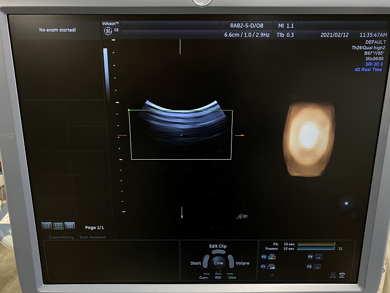 Old GE Healthcare Voluson E8 Ultrasound